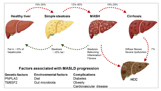代謝功能障礙相關性脂肪肝（MASLD）小核酸療法研究模型